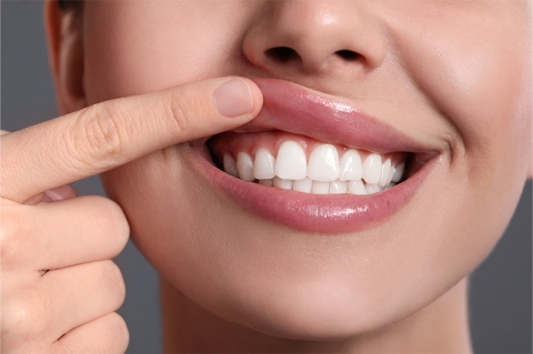 Periodoncia