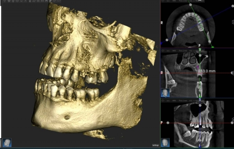 T.A.C. Dental (CBCT)