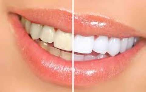 Odontolog&iacute;a Est&eacute;tica