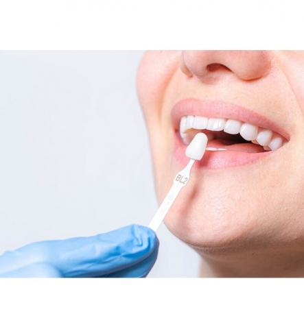 Est&eacute;tica Dental 